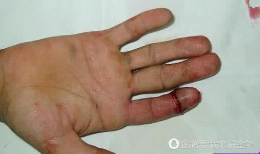 出款通道维护不给出怎么办呢.概述（图）